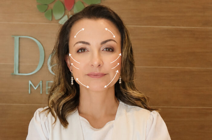 Dra Erika Debs - Dermatologista em Atibaia - Lifting com Fios de PDO Dra Erika Debs - Dermatologista em Atibaia - Lifting com Fios de PDO