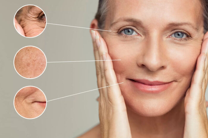 Dra Erika Debs - Dermatologista em Atibaia - Aplicação de Ácido Poli-L-Lático Dra Erika Debs - Dermatologista em Atibaia - Aplicação de Ácido Poli-L-Lático