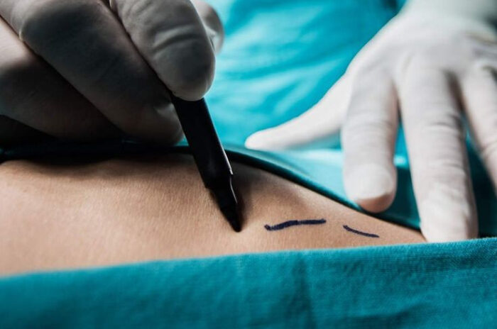Dra Erika Debs - Dermatologista em Atibaia - Cirurgia de Câncer de Pele Dra Erika Debs - Dermatologista em Atibaia - Cirurgia de Câncer de Pele