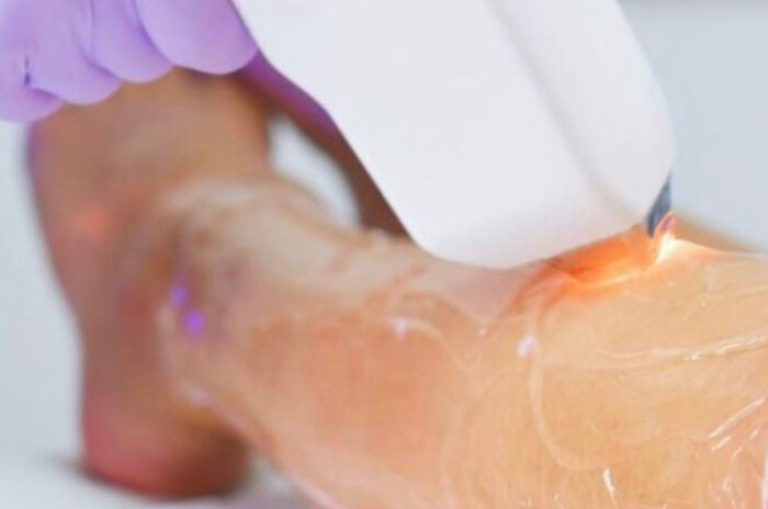 Dra Erika Debs - Dermatologista em Atibaia - Depilação a Laser Dra Erika Debs - Dermatologista em Atibaia - Depilação a Laser