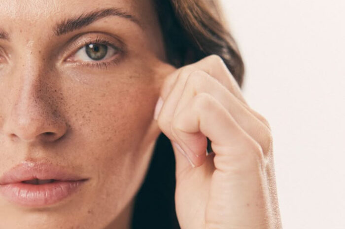 Dra Erika Debs - Dermatologista em Atibaia - Eletrocoagulação de Lesões Faciais Dra Erika Debs - Dermatologista em Atibaia - Eletrocoagulação de Lesões Faciais
