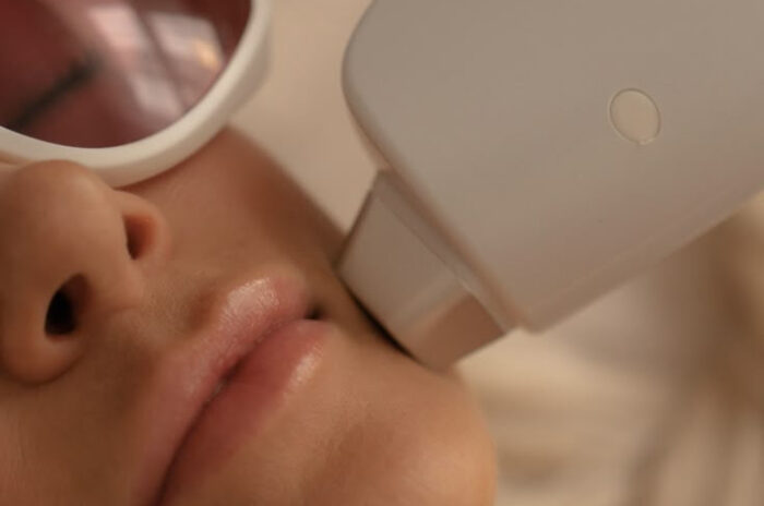 Dra Erika Debs - Dermatologista em Atibaia - Lasers e Luz Pulsada Dra Erika Debs - Dermatologista em Atibaia - Lasers e Luz Pulsada