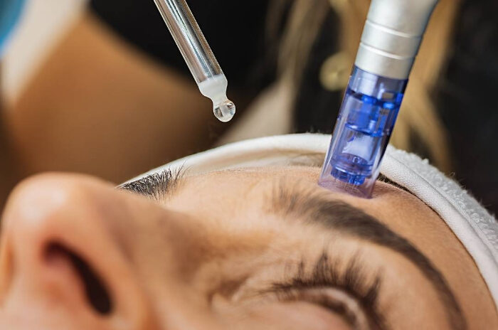 Dra Erika Debs - Dermatologista em Atibaia - MMP (Microinfusão de Medicamentos na Pele) Dra Erika Debs - Dermatologista em Atibaia - MMP (Microinfusão de Medicamentos na Pele)